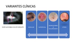 VARIANTES CLÍNICAS
NODULAR SUPERFICIAL
MORFEIFORME
O
ESCLEROSANTE
OTROS
Lesión premaligna nevo de Jadassohn
 
