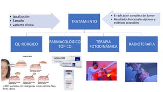 • Localización
• Tamaño
• variante clínica
TRATAMIENTO
QUIRÚRGICO
FARMACOLÓGICO
TÓPICO
TERAPIA
FOTODINÁMICA
RADIOTERAPIA
• Erradicación completa del tumor
• Resultados funcionales óptimos y
estéticos aceptables
<2CM escisión con márgenes 4mm elimina Neo
95% casos
 