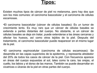 Tipos:
Existen muchos tipos de cáncer de piel no melanoma, pero hay dos que
son los más comunes: el carcinoma basocelular y el carcinoma de células
escamosas.
•El carcinoma basocelular (cáncer de células basales): Es un tumor de
crecimiento lento. Es muy raro que un cáncer de células basales se
extienda a partes distantes del cuerpo. No obstante, si un cáncer de
células basales se deja sin tratar, puede extenderse a las áreas cercanas y
afectar los huesos, así como otros tejidos de la piel. Después del
tratamiento, el carcinoma basocelular puede reaparecer en el mismo lugar
de la piel.
•El carcinoma espinocelular (carcinoma de células escamosas): Se
desarrolla en las capas superiores de la epidermis, y representa alrededor
del 20% de todos los casos de cáncer de la piel. Con frecuencia aparece
en áreas del cuerpo expuestas al sol, tales como la cara, las orejas, el
cuello, los labios y el dorso de las manos. También se puede desarrollar en
cicatrices o úlceras de la piel en otras partes del cuerpo.

 