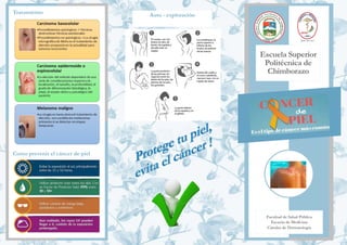 Escuela Superior
Politécnica de
Chimborazo
Tratamiento
Facultad de Salud Pública
Escuela de Medicina
Cátedra de Dermatología
Auto - exploración
Como prevenir el cáncer de piel
 