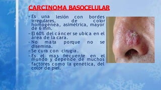 cancer de piel (2).pptx