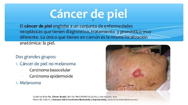 Cancer De Piel | cancer de piel nieves fernandez Cancer De Piel | cancer de piel nieves fernandez