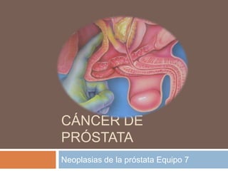 Cáncer de próstata Neoplasias de la próstata Equipo 7 