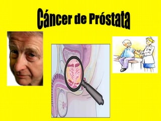 Cáncer de Próstata 