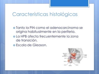 Características histológicas

 Tanto  la PIN como el adenocarcinoma se
  origina habitualmente en la periferia.
 La HPB afecta frecuentemente la zona
  de transición.
 Escala de Gleason.
 