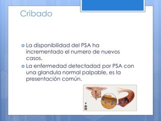 Cribado


 La disponibilidad del PSA ha
  incrementado el numero de nuevos
  casos.
 La enfermedad detectadad por PSA con
  una glandula normal palpable, es la
  presentación común.
 