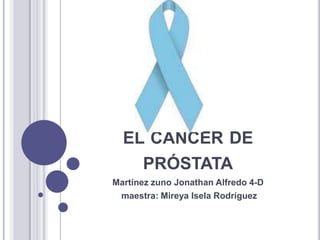 Cel cáncer de próstata Martínez zuno Jonathan Alfredo 4-D  maestra: Mireya Isela Rodríguez 