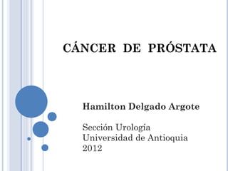 CÁNCER DE PRÓSTATA
Hamilton Delgado Argote
Sección Urología
Universidad de Antioquia
2012
 