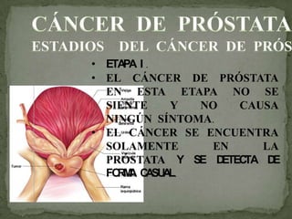 • ETAPA I .
• EL CÁNCER DE PRÓSTATA
EN ESTA ETAPA NO SE
SIENTE Y NO CAUSA
NINGÚN SÍNTOMA.
• EL CÁNCER SE ENCUENTRA
SOLAMENTE EN LA
PRÓSTATA Y SE DETECTA DE
FORMA CASUAL.
 