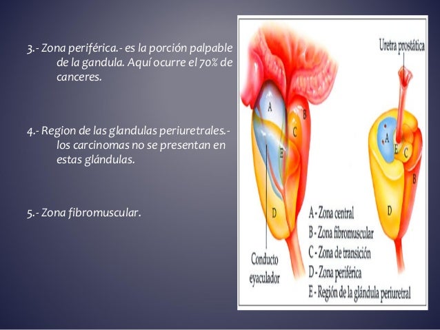 La operación láser de las venas varicosas