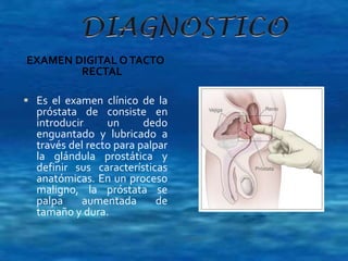 EXAMEN DIGITAL O TACTO 
RECTAL 
 Es el examen clínico de la 
próstata de consiste en 
introducir un dedo 
enguantado y lubricado a 
través del recto para palpar 
la glándula prostática y 
definir sus características 
anatómicas. En un proceso 
maligno, la próstata se 
palpa aumentada de 
tamaño y dura. 
 