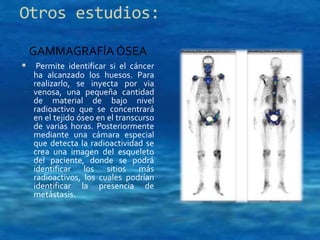 Otros estudios: 
GAMMAGRAFÍA ÓSEA 
 Permite identificar si el cáncer 
ha alcanzado los huesos. Para 
realizarlo, se inyecta por via 
venosa, una pequeña cantidad 
de material de bajo nivel 
radioactivo que se concentrará 
en el tejido óseo en el transcurso 
de varias horas. Posteriormente 
mediante una cámara especial 
que detecta la radioactividad se 
crea una imagen del esqueleto 
del paciente, donde se podrá 
identificar los sitios más 
radioactivos, los cuales podrían 
identificar la presencia de 
metástasis. 
 