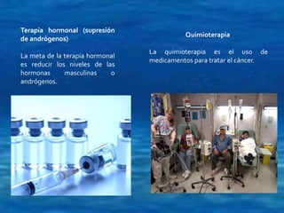 Terapia hormonal (supresión 
de andrógenos) 
La meta de la terapia hormonal 
es reducir los niveles de las 
hormonas masculinas o 
andrógenos. 
Quimioterapia 
La quimioterapia es el uso de 
medicamentos para tratar el cáncer. 
 