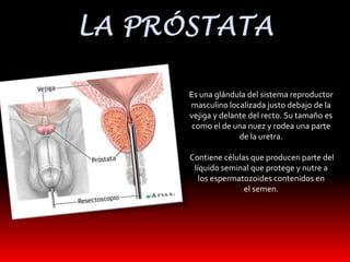 Es una glándula del sistema reproductor 
masculino localizada justo debajo de la 
vejiga y delante del recto. Su tamaño es 
como el de una nuez y rodea una parte 
de la uretra. 
Contiene células que producen parte del 
líquido seminal que protege y nutre a 
los espermatozoides contenidos en 
el semen. 
 