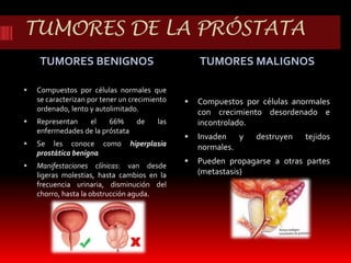 TUMORES DE LA PRÓSTATA 
TUMORES BENIGNOS TUMORES MALIGNOS 
 Compuestos por células normales que 
se caracterizan por tener un crecimiento 
ordenado, lento y autolimitado. 
 Representan el 66% de las 
enfermedades de la próstata 
 Se les conoce como hiperplasia 
prostática benigna 
 Manifestaciones clínicas: van desde 
ligeras molestias, hasta cambios en la 
frecuencia urinaria, disminución del 
chorro, hasta la obstrucción aguda. 
 Compuestos por células anormales 
con crecimiento desordenado e 
incontrolado. 
 Invaden y destruyen tejidos 
normales. 
 Pueden propagarse a otras partes 
(metastasis) 
 