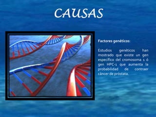 Factores genéticos: 
Estudios genéticos han 
mostrado que existe un gen 
específico del cromosoma 1 ó 
gen HPC-1 que aumenta la 
probabilidad de contraer 
cáncer de próstata. 
 