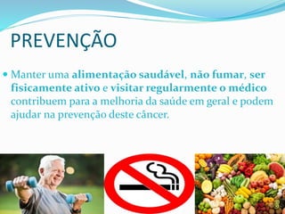  Manter uma alimentação saudável, não fumar, ser
fisicamente ativo e visitar regularmente o médico
contribuem para a melhoria da saúde em geral e podem
ajudar na prevenção deste câncer.
PREVENÇÃO
 
