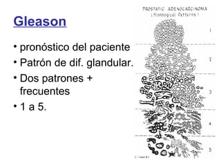 Gleason
• pronóstico del paciente
• Patrón de dif. glandular.
• Dos patrones +
frecuentes
• 1 a 5.
 