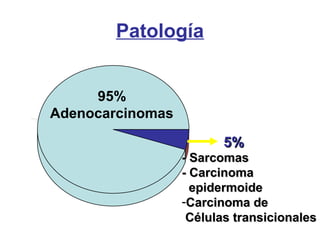 95%
Adenocarcinomas
5%5%
- Sarcomas- Sarcomas
- Carcinoma- Carcinoma
epidermoideepidermoide
-Carcinoma deCarcinoma de
Células transicionalesCélulas transicionales
Patología
 