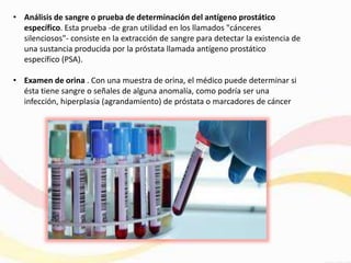 • Análisis de sangre o prueba de determinación del antígeno prostático
específico. Esta prueba -de gran utilidad en los llamados "cánceres
silenciosos"- consiste en la extracción de sangre para detectar la existencia de
una sustancia producida por la próstata llamada antígeno prostático
específico (PSA).
• Examen de orina . Con una muestra de orina, el médico puede determinar si
ésta tiene sangre o señales de alguna anomalía, como podría ser una
infección, hiperplasia (agrandamiento) de próstata o marcadores de cáncer
 
