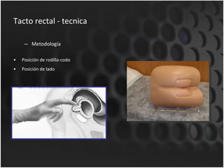 Tacto rectal - tecnica Metodología Posición de rodilla-codo Posición de lado 