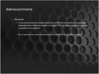 Adenocarcinoma Ubicación En los carcinomas en estadio clínico T2 y el 85% de los tumores no palpables diagnosticados mediante biopsia con aguja (T1c), la masa tumoral principal se encuentra en la periferia En el resto de los casos los tumores se localizan en la zona de transición.  