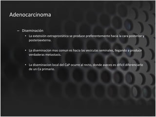 Adenocarcinoma Diseminación La extensión extraprostática se produce preferentemente hacia la cara posterior y posteroexterna. La diseminacion mas comun es hacia las vesiculas seminales, llegando a producir verdaderas metastasis. La diseminacion local del CaP ocurre al recto, donde aveces es dificil diferenciarlo de un Ca primario. 