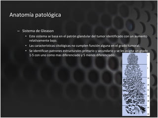 Anatomía patológica Sistema de Gleason Este sistema se basa en el patrón glandular del tumor identificado con un aumento relativamente bajo. Las características citológicas no cumplen función alguna en el grado tumoral. Se identifican patrones estructurales primario y secundario y se les asigna un grado 1-5 con uno como mas diferenciado y 5 menos diferenciado. 