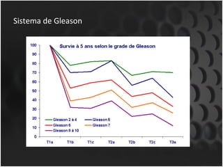 Sistema de Gleason 