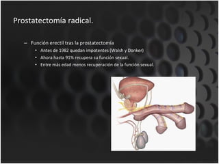 Prostatectomía radical. Función erectil tras la prostatectomía Antes de 1982 quedan impotentes (Walsh y Donker) Ahora hasta 91% recupera su función sexual. Entre más edad menos recuperación de la función sexual. 
