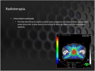 Radioterapia. Intensidad modulada Permite identificar la región a tratar junto a organos normales críticos vecinos para poder prescribir a cada diana y estructura la dosis de radiación y los volumenes objetivo  