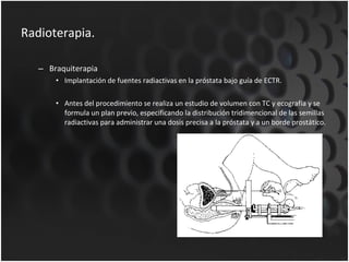 Radioterapia. Braquiterapia Implantación de fuentes radiactivas en la próstata bajo guía de ECTR. Antes del procedimiento se realiza un estudio de volumen con TC y ecografía y se formula un plan previo, especificando la distribución tridimencional de las semillas radiactivas para administrar una dosis precisa a la próstata y a un borde prostático. 