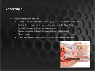 Crioterapia. Mecanismo de destrucción Formación de cristales extracelulares que producen deshidratación celular Cambio del pH debido a la concentración anormal de electrolitos Shock térmico con lesión de las lipoproteínas Ruptura mecánica de la membrana celular por cristalización Edema celular Estasis vascular secundaria a trombosis después del congelamiento. 