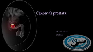 Cáncer de próstata
DR. David TELLEZ
UROLOGO
 