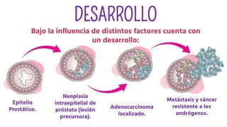 DESARROLLO
Bajo la influencia de distintos factores cuenta con
un desarrollo:
Epitelio
Prostático.
Neoplasia
intraepitelial de
próstata (lesión
precursora).
Adenocarcinoma
localizado.
Metástasis y cáncer
resistente a los
andrógenos.
 