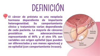 DEFINICIÓN
El cáncer de próstata es una neoplasia
hormono dependiente de importante
heterogeneidad. Su comportamiento
clínico y tratamiento varían dependiendo
de cada paciente. La mayoría de cánceres
prostáticos son adenocarcinomas
representando el 95% y el otro 5% son
variables con origen epitelial (que pueden
ser diferenciadas y son menos agresivas) y
no epitelial (con comportamiento invasor).
 