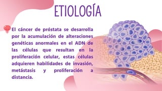 ETIOLOGÍA
El cáncer de próstata se desarrolla
por la acumulación de alteraciones
genéticas anormales en el ADN de
las células que resultan en la
proliferación celular, estas células
adquieren habilidades de invasión,
metástasis y proliferación a
distancia.
 