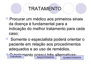 TRATAMENTO
Procurar um médico aos primeiros sinais
da doença é fundamental para a
indicação do melhor tratamento para cada
caso;
 Somente o especialista poderá orientar o
paciente em relação aos procedimentos
adequados e ao uso de remédios.
O tratamento possui três alternativas:RADIOTERAPIACIRURGIA QUIMIOTERAPIA
 
