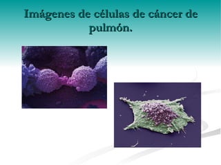 Imágenes de células de cáncer de pulmón. 