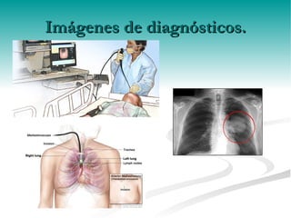 Rayos X . Imágenes de diagnósticos. 