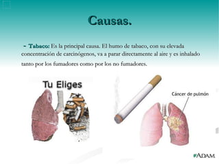 Causas. -  Tabaco:  Es la principal causa. El humo de tabaco, con su elevada concentración de carcinógenos, va a parar directamente al aire y es inhalado tanto por los fumadores como por los no fumadores.   