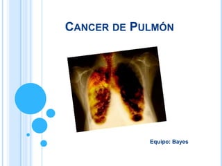CANCER DE PULMÓN




            Equipo: Bayes
 