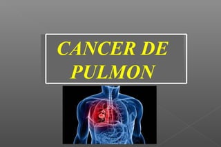 CANCER DE
PULMON

 