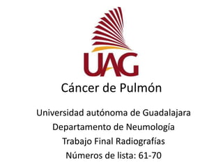 Cáncer de Pulmón 
Universidad autónoma de Guadalajara 
Departamento de Neumología 
Trabajo Final Radiografías 
Números de lista: 61-70 
 
