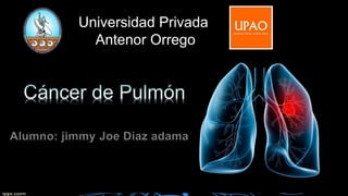 Universidad Privada
Antenor Orrego
Alumno: jimmy Joe Díaz adama
 