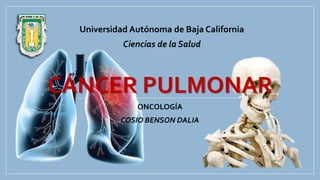 CÁNCER PULMONAR
ONCOLOGÍA
COSIO BENSON DALIA
Universidad Autónoma de Baja California
Ciencias de la Salud
 