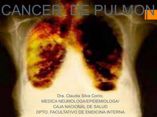 CANCER DE PULMON
Dra. Claudia Silva Corini.
MEDICA NEUMOLOGA/EPIDEMIOLOGA/
CAJA NACIONAL DE SALUD
DPTO. FACULTATIVO DE EMDICINA INTERNA
 