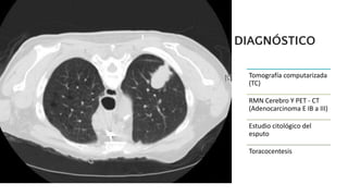 DIAGNÓSTICO
Tomografía computarizada
(TC)
RMN Cerebro Y PET - CT
(Adenocarcinoma E IB a III)
Estudio citológico del
esputo
Toracocentesis
 