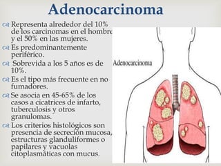 Adenocarcinoma
 Representa alrededor del 10%
de los carcinomas en el hombre
y el 50% en las mujeres.
 Es predominantemente
periférico.
 Sobrevida a los 5 años es de
10%.
 Es el tipo más frecuente en no
fumadores.
 Se asocia en 45-65% de los
casos a cicatrices de infarto,
tuberculosis y otros
granulomas.
 Los criterios histológicos son
presencia de secreción mucosa,
estructuras glanduliformes o
papilares y vacuolas
citoplasmáticas con mucus.
 