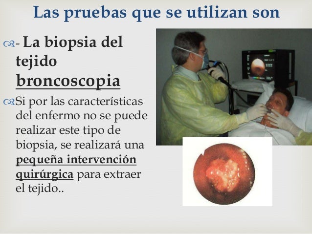 dieta para bajar de peso y quemar grasa abdominal Los dieta para bajar de peso y quemar grasa abdominal lograr